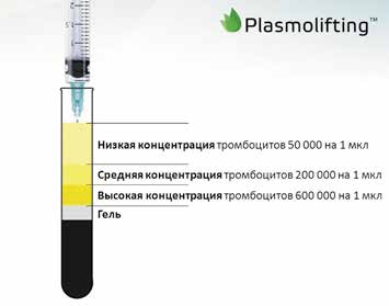Разделение крови на компоненты после центрифугирования