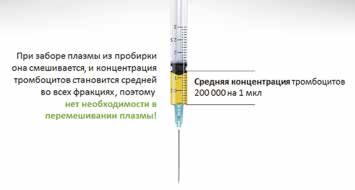 Аутологичная плазма в шприце